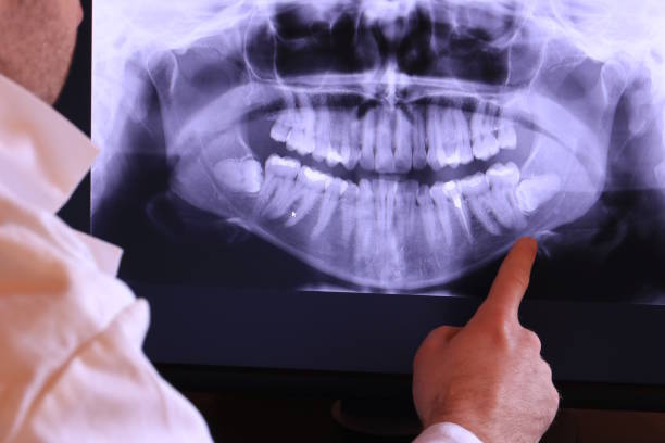 Best Emergency TMJ Treatment in Seabrook Island, SC